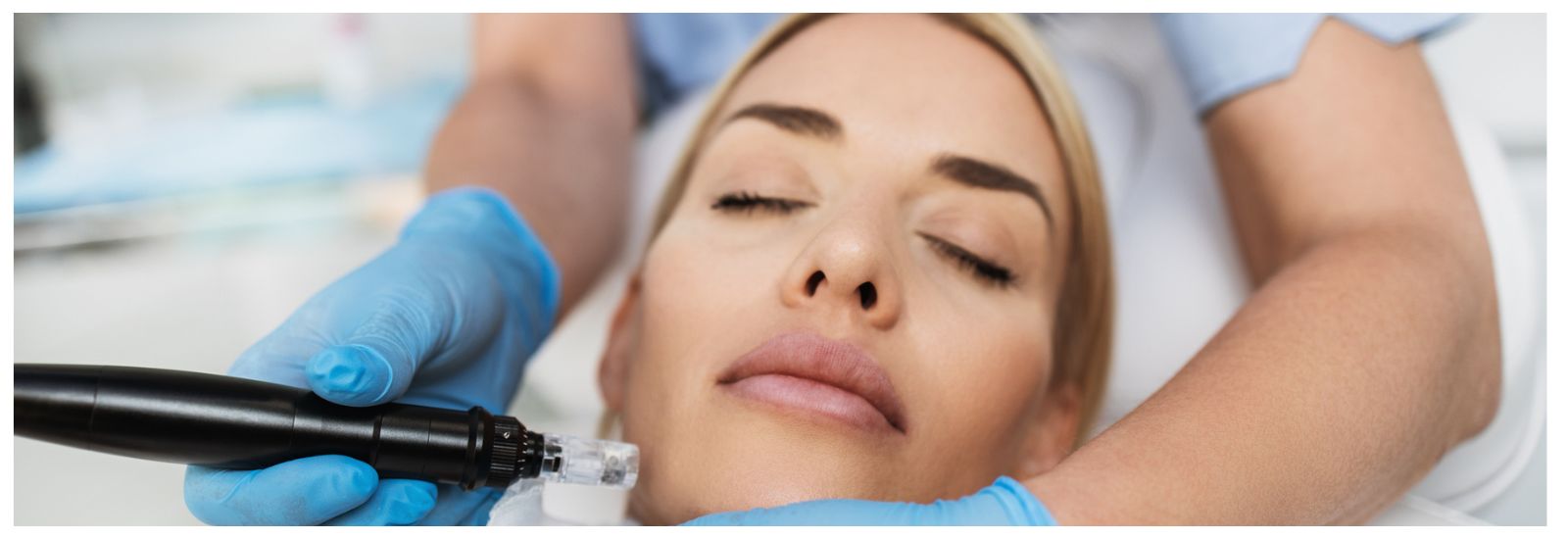 Patient undergoing microneedling